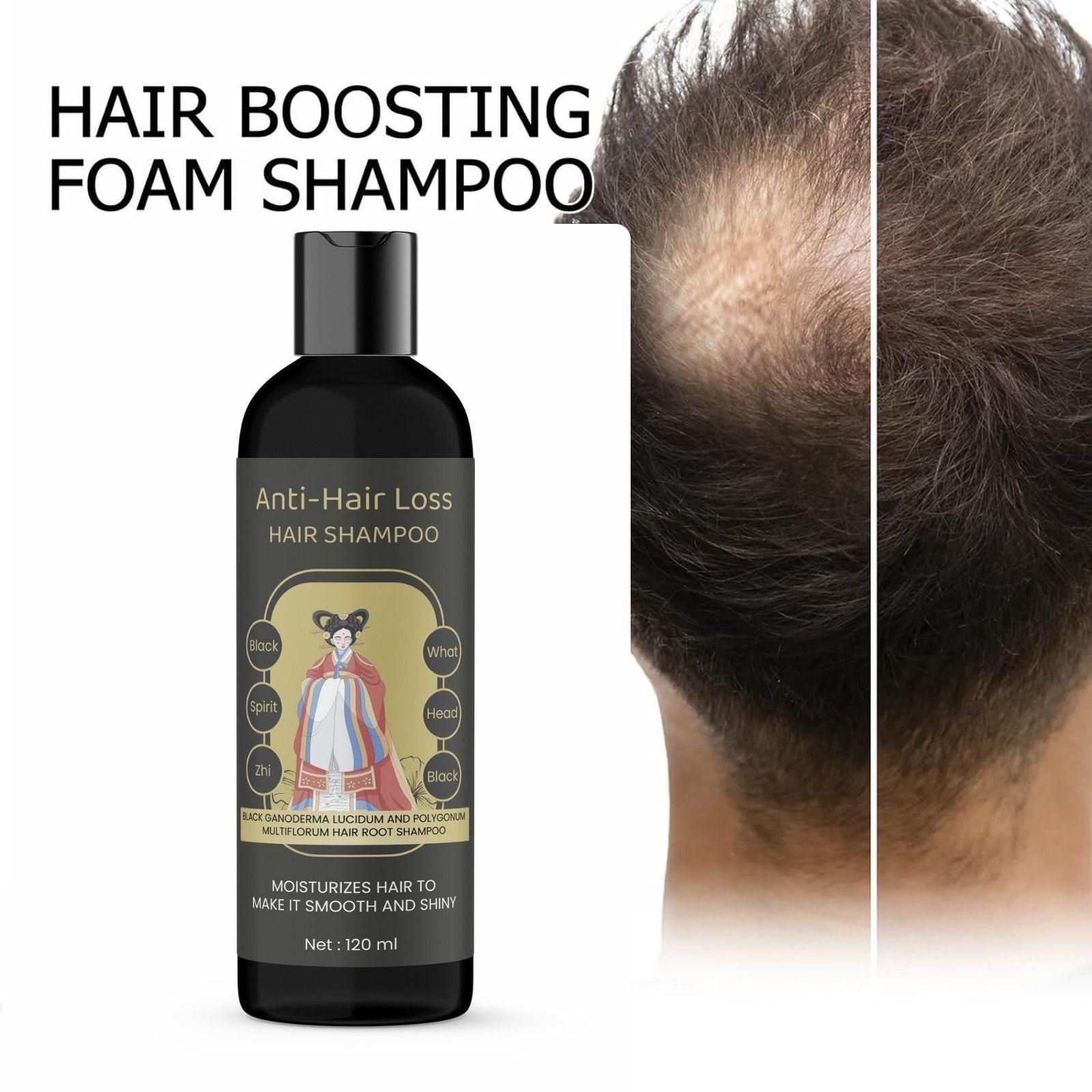 ANTI-HAIR LOSS HAIR SHAMPOO Black What Spirit (Pack of 2)
